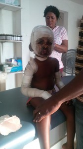 For Haiti has the unique opportunity of ministering to burn victims. (Photo courtesy of For Haiti)