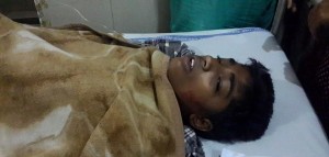 "Fodor" suffered burns on 55% of his body.  (Photo courtesy of Forgotten Missionaries International)